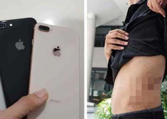 Remaja Ini Jual Ginjal Rp 465 juta Demi Beli Iphone, Kini Menyesal Nasibnya Miris!