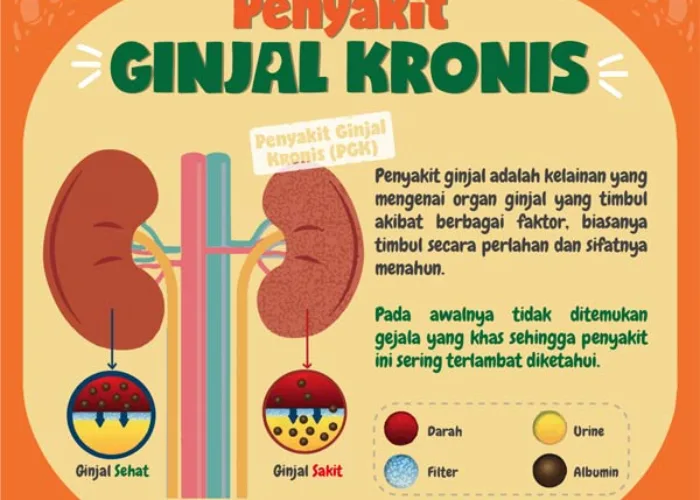 739.208 Warga +62 Alami Gagal Ginjal Kronik, Kenali Penyebabnya