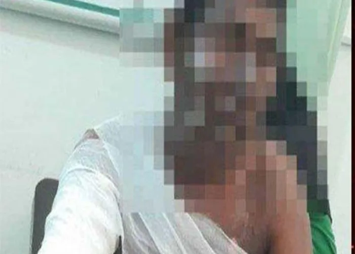 Ajakan Berhubungan Intim Ditolak Istri, Suami Nekat Bakar Diri
