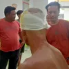Kepala Digigit Buaya, Warga Rokan Hilir Selamat Setelah Duel di Sungai
