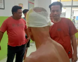 Kepala Digigit Buaya, Warga Rokan Hilir Selamat Setelah Duel di Sungai