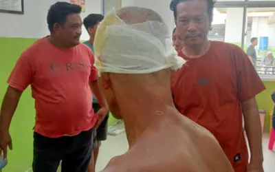 Kepala Digigit Buaya, Warga Rokan Hilir Selamat Setelah Duel di Sungai