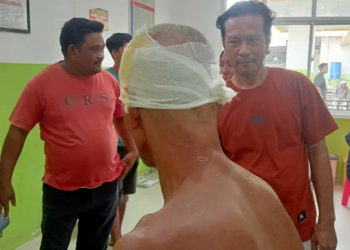 Kepala Digigit Buaya, Warga Rokan Hilir Selamat Setelah Duel di Sungai