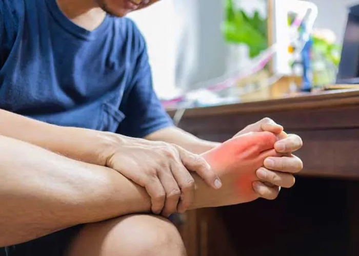 10 Makanan Pemicu Asam Urat yang Sering Dikonsumsi, Nomor 1 Tak Banyak Disadari